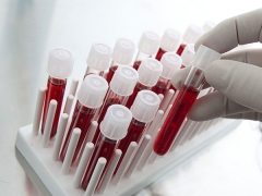 Decoding blood tests in children