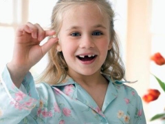 Removal of milk and molars in children