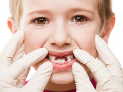 Frequent problems with gums in children