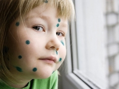 How many days do you have to be at home with chicken pox?