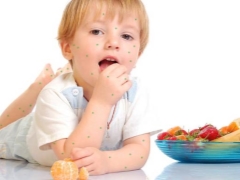 Diet in children with chickenpox