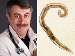 Dr. Komarovsky about worms in children