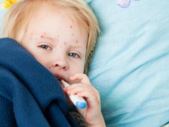 What does an enteroviral infection rash look like in children?