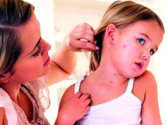 Rash on the child's neck