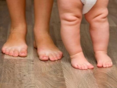 Valgus deformity in children