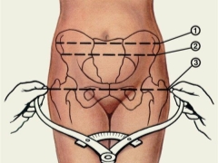 How to measure the size of the pelvis during pregnancy, and what standards exist?