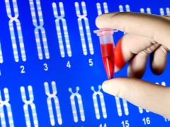 What is a non-invasive prenatal DNA test and why is it done during pregnancy?