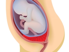 The position of the placenta in relation to the internal throat