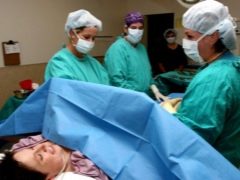 Epidural anesthesia for caesarean section