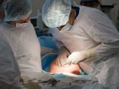 Is it possible to make a fourth cesarean section? Reviews and opinions of doctors