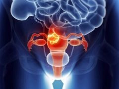 Diseases of the uterus in terms of psychosomatics