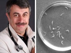 Dr. Komarovsky about pinworms and other parasites