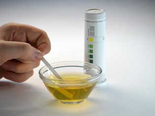 Determination of urine glucose test strips