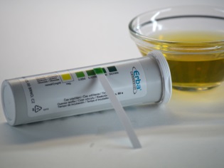 Determination of urine glucose test strips