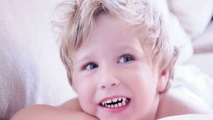 Bruxism: baby grind his teeth