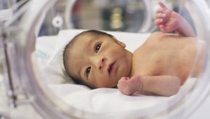 Pneumonia in premature babies