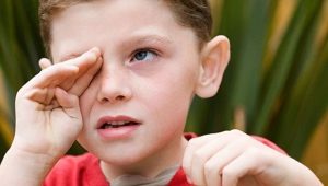 Bacterial conjunctivitis in children