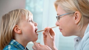 Viral sore throat in children