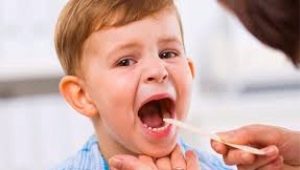 What does the throat of a child with pharyngitis look like?