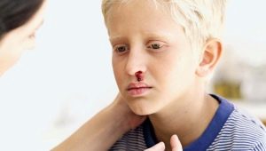 Thrombocytopenic purpura in children