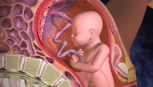 What does the placenta look like and where is it attached?