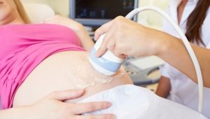 Causes and treatment of hematoma in early pregnancy