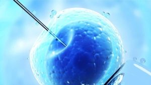 IVF short protocol by day: scheme and description