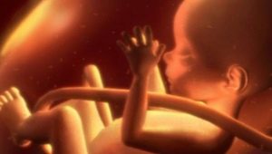 Cord fetal entanglement: causes and consequences