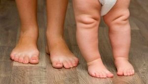 Massage and exercise for clubfoot in children