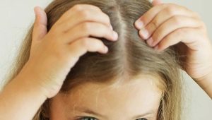 Dandruff psychosomatics in children and adults