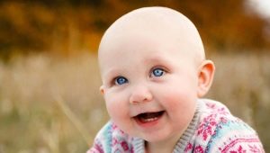 Alopecia in children: causes and methods of treatment