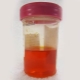 Red urine in a child