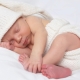 Birth injuries of newborns