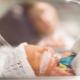 Bronchopulmonary dysplasia in premature babies