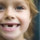 What teeth do children have?