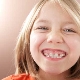 Plates for the alignment of teeth in children