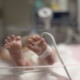 Help for premature babies in Russia