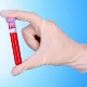 WBC blood test in children