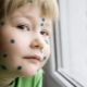 How many days do you have to be at home with chicken pox?