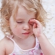 Allergic conjunctivitis in children