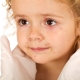 Rubella in children: symptoms, treatment and prevention