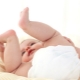 Hip dysplasia in newborns and infants