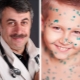 Dr. Komarovsky: what is chickenpox and how to treat it