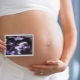 At what time do the third ultrasound during pregnancy and on what rates of indicators to focus?