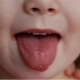 What to do if a child has a rash in the mouth?