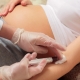 What should be the urea in the blood during pregnancy is normal? Causes of deviations