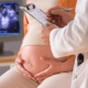 Why is pelvic presentation of the fetus considered dangerous, what causes it and how does the birth proceed?