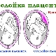 Symptoms and effects of placental abruption in late pregnancy