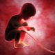 Types of umbilical cord attachments and effects on the fetus