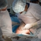 Is it possible to make a fourth cesarean section? Reviews and opinions of doctors